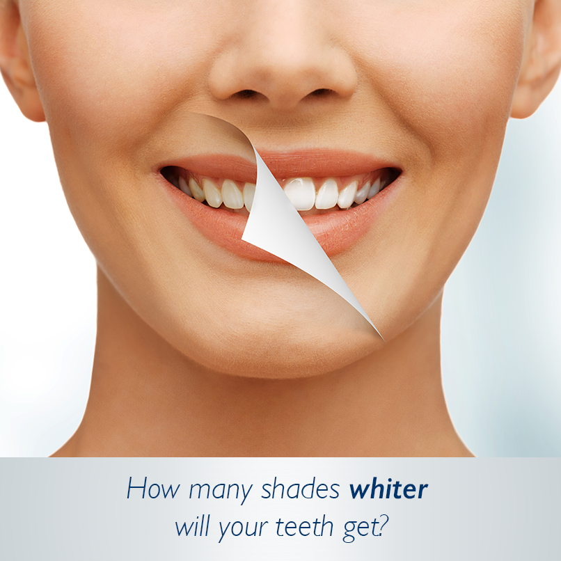  of teeth whitening the at home treatment takes approximately two weeks