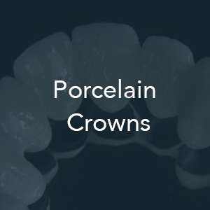 porcelain crowns